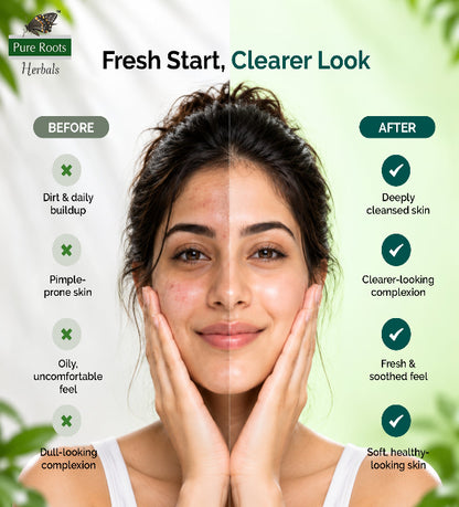 Neem Face Wash for Pimple Control 100 ml (Pack of 3)